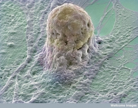 Cellule souche embryonnaire